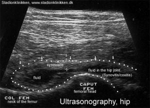 ultrasonic-image - Sportnetdoc